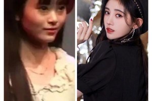鞠婧祎陈小纭等明星五官修整成功案例分享